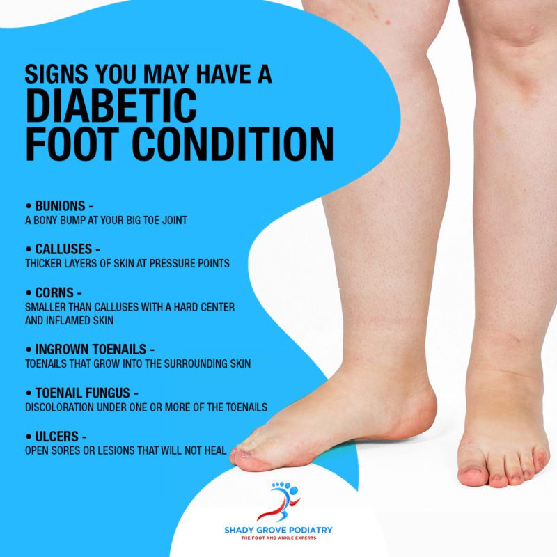 Signs You May Have A Diabetic Foot Condition [Infographic]